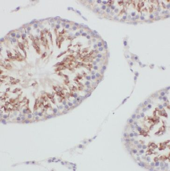 GKAP1 Rabbit Polyclonal Antibody