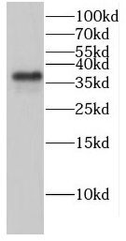 GLRX3 Rabbit Polyclonal Antibody