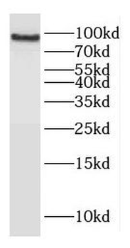 NR3C1 Rabbit Polyclonal Antibody