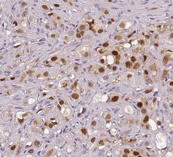 NR3C1 Rabbit Polyclonal Antibody