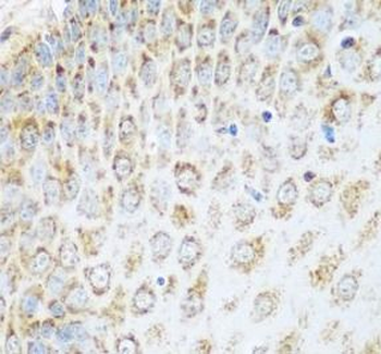 GLUD1 Rabbit Polyclonal Antibody