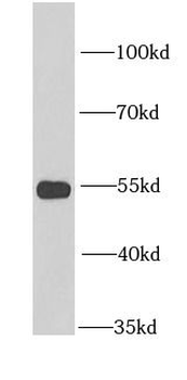 GLUD2 Rabbit Polyclonal Antibody