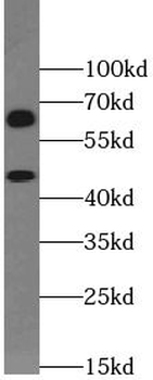 SLC2A2 Rabbit Polyclonal Antibody