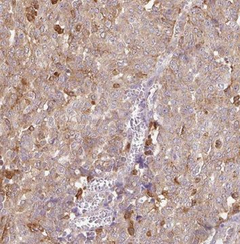 GLYATL1 Rabbit Polyclonal Antibody