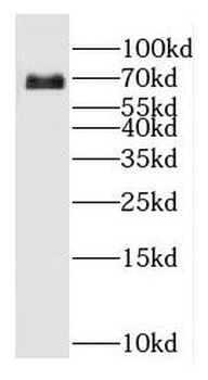 GPC3 Antibody