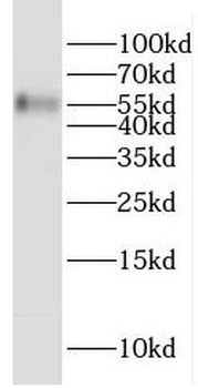 GMCL1 Rabbit Polyclonal Antibody