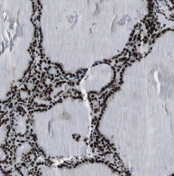 GMCL1 Rabbit Polyclonal Antibody