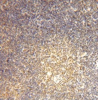 GMDS Rabbit Polyclonal Antibody