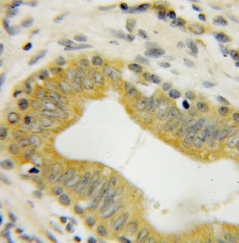 GMEB2 Rabbit Polyclonal Antibody