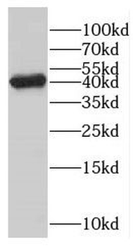 GMPPB Antibody
