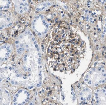 GNA14 Rabbit Polyclonal Antibody