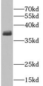 GNAI2 Rabbit Polyclonal Antibody