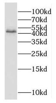 GNAS Rabbit Polyclonal Antibody