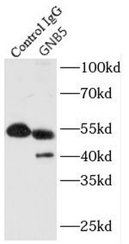 GNB5 Rabbit Polyclonal Antibody