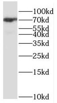 GNL1 Rabbit Polyclonal Antibody