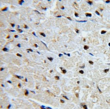 GNL1 Rabbit Polyclonal Antibody