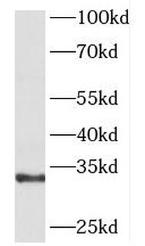 GNPDA1 Antibody