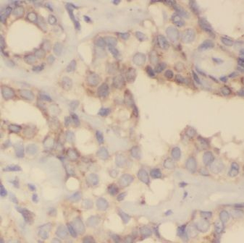 GNPDA2 Rabbit Polyclonal Antibody