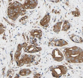 GNS Rabbit Polyclonal Antibody