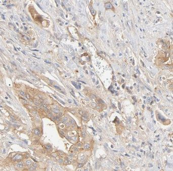 GOPC Rabbit Polyclonal Antibody