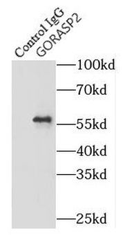 GORASP2 Rabbit Polyclonal Antibody