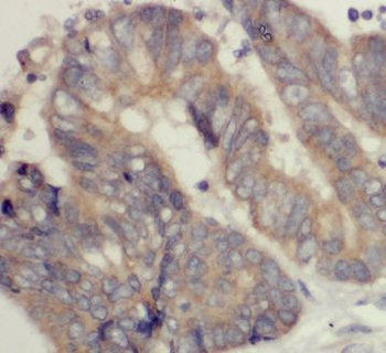 GORASP2 Rabbit Polyclonal Antibody