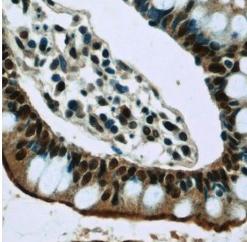 GPBP1 Rabbit Polyclonal Antibody