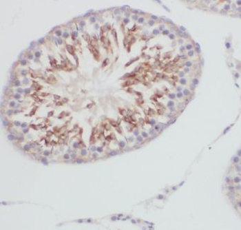 GPX5 Rabbit Polyclonal Antibody