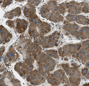 GPX7 Rabbit Polyclonal Antibody