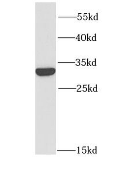 GRB2 Rabbit Polyclonal Antibody