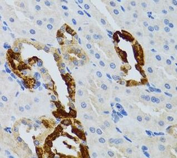 GRB2 Rabbit Polyclonal Antibody