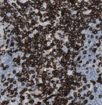 GRK2 Rabbit Polyclonal Antibody