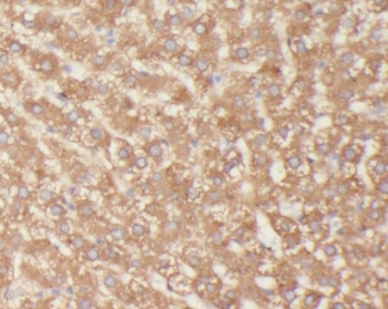 GH1 Rabbit Polyclonal Antibody