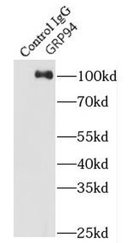HSP90B1 Rabbit Polyclonal Antibody