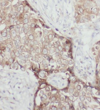 HSP90B1 Rabbit Polyclonal Antibody