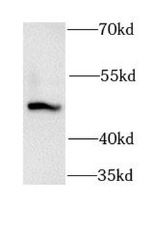 GSK3A Rabbit Polyclonal Antibody