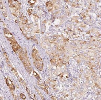 GSK3A Rabbit Polyclonal Antibody