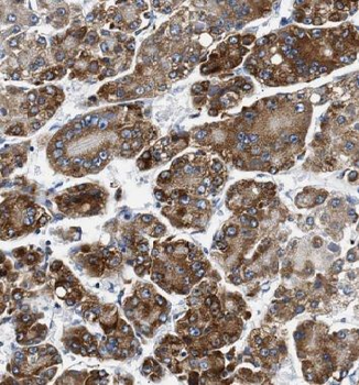 GSTK1 Rabbit Polyclonal Antibody