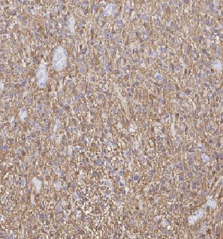 GSTM1 Rabbit Polyclonal Antibody