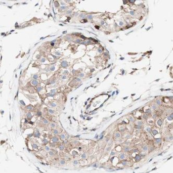 GSTM3 Rabbit Polyclonal Antibody