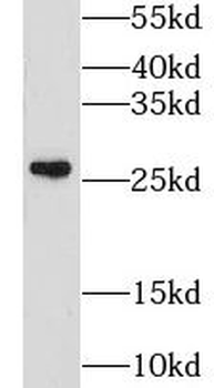 GSTM4 Rabbit Polyclonal Antibody