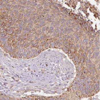 GSTM4 Rabbit Polyclonal Antibody