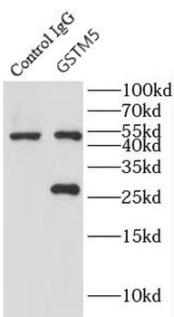 GSTM5 Rabbit Polyclonal Antibody