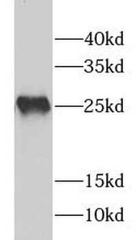 GSTP1 Rabbit Polyclonal Antibody