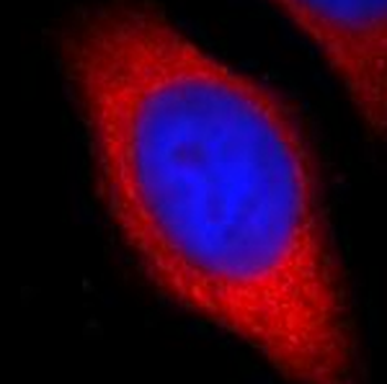 GSTP1 Rabbit Polyclonal Antibody