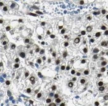 GSTP1 Rabbit Polyclonal Antibody