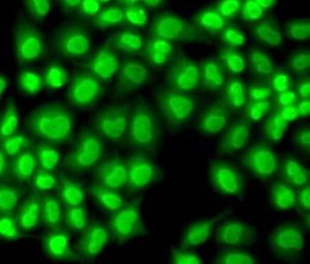 GTF2F1 Rabbit Polyclonal Antibody
