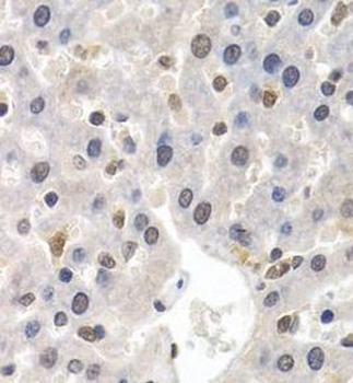 GTF2F1 Rabbit Polyclonal Antibody