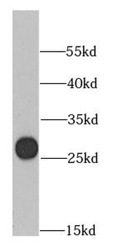 GTF2F2 Rabbit Polyclonal Antibody