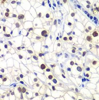 GTF2F2 Rabbit Polyclonal Antibody